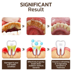Charger l'image dans la galerie, Dentifrice blanchissant probiotique Gestion de la santé bucco-dentaire(Élimine des années de taches)
