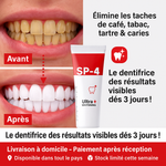 Charger l'image dans la galerie, Dentifrice blanchissant probiotique Gestion de la santé bucco-dentaire(Élimine des années de taches)
