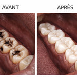 Charger l'image dans la galerie, fini les dents jaunes, la mauvaise haleine et les taches qui gâchent votre sourire
