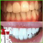 Charger l'image dans la galerie, Dentifrice blanchissant probiotique Gestion de la santé bucco-dentaire(Élimine des années de taches)
