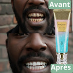 Charger l'image dans la galerie, fini les dents jaunes, la mauvaise haleine et les taches qui gâchent votre sourire
